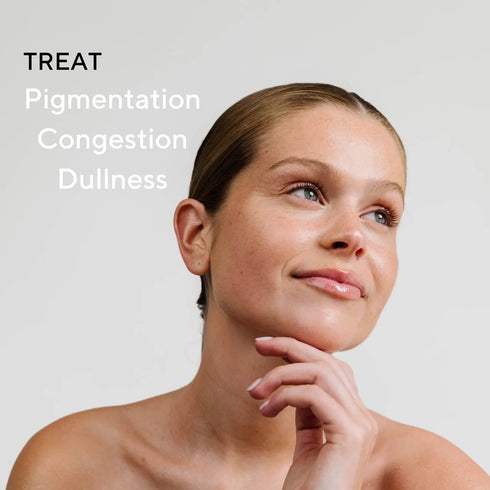 SKIN FORMULAS MASK EXFOLIATOR - ŠVEIČIAMOJI KAUKĖ SU AHA RŪGŠTIMIS BEI TRANEKSAMO RŪGŠTIMI, 60ML.
