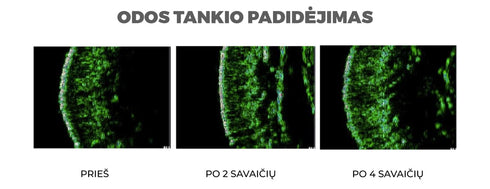 ODOS ELASTINGUMUI GERINTI VEIDO KREMAS „LIFTING CREAM”