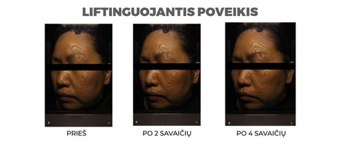 ODOS ELASTINGUMUI GERINTI VEIDO KREMAS „LIFTING CREAM”