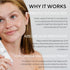 SKIN FORMULAS CLEAR SKIN TREATMENT – SERUMAS MAŽINANTIS RIEBALŲ IŠSISKYRIMĄ, 50ml.